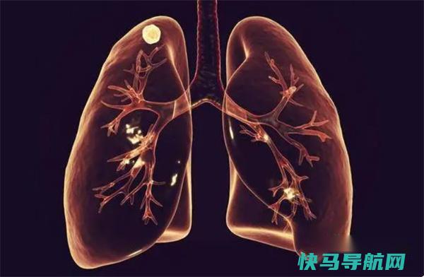 为啥一到凌晨3、4点就早醒 中医坦言：可能是身体这2处“堵”了 第2张